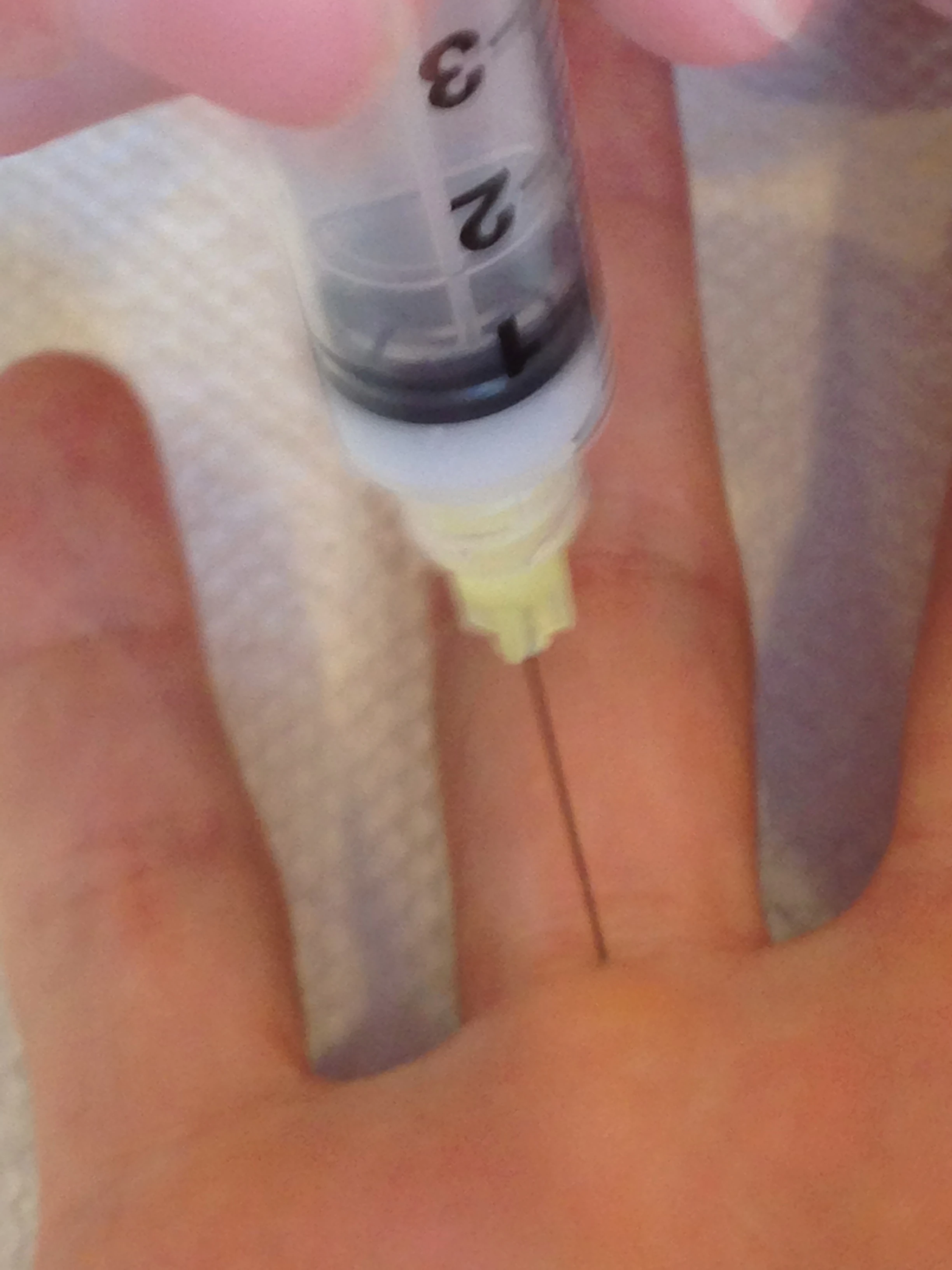 Lisa washed her hands pretty good, after the chicken feeding, before she injected my finger.