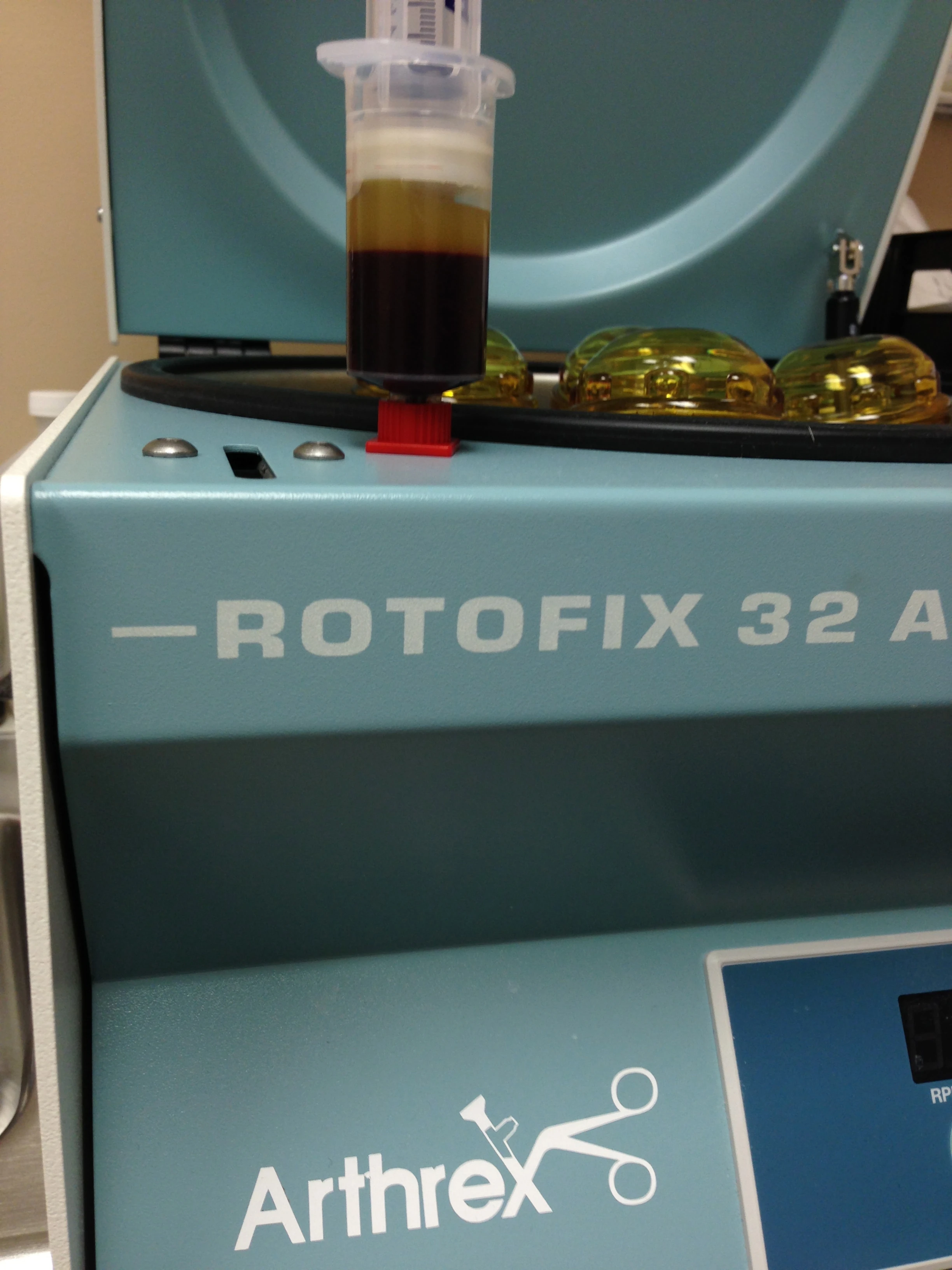 The separated plasma and platelets.