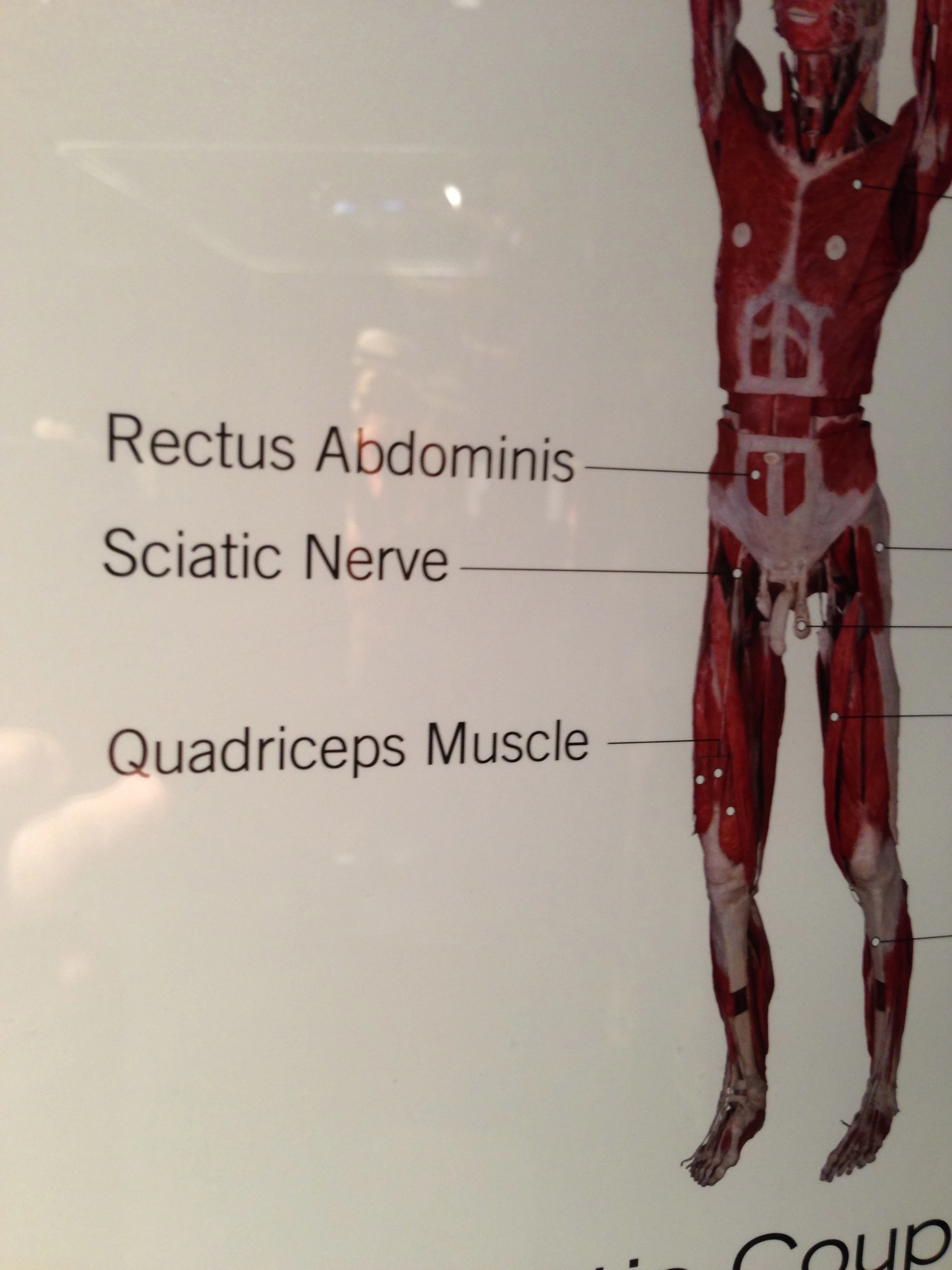 I&rsquo;m not sure about the accuracy of all the information. I&rsquo;m pretty sure that isn&rsquo;t where the sciatic nerve is. 