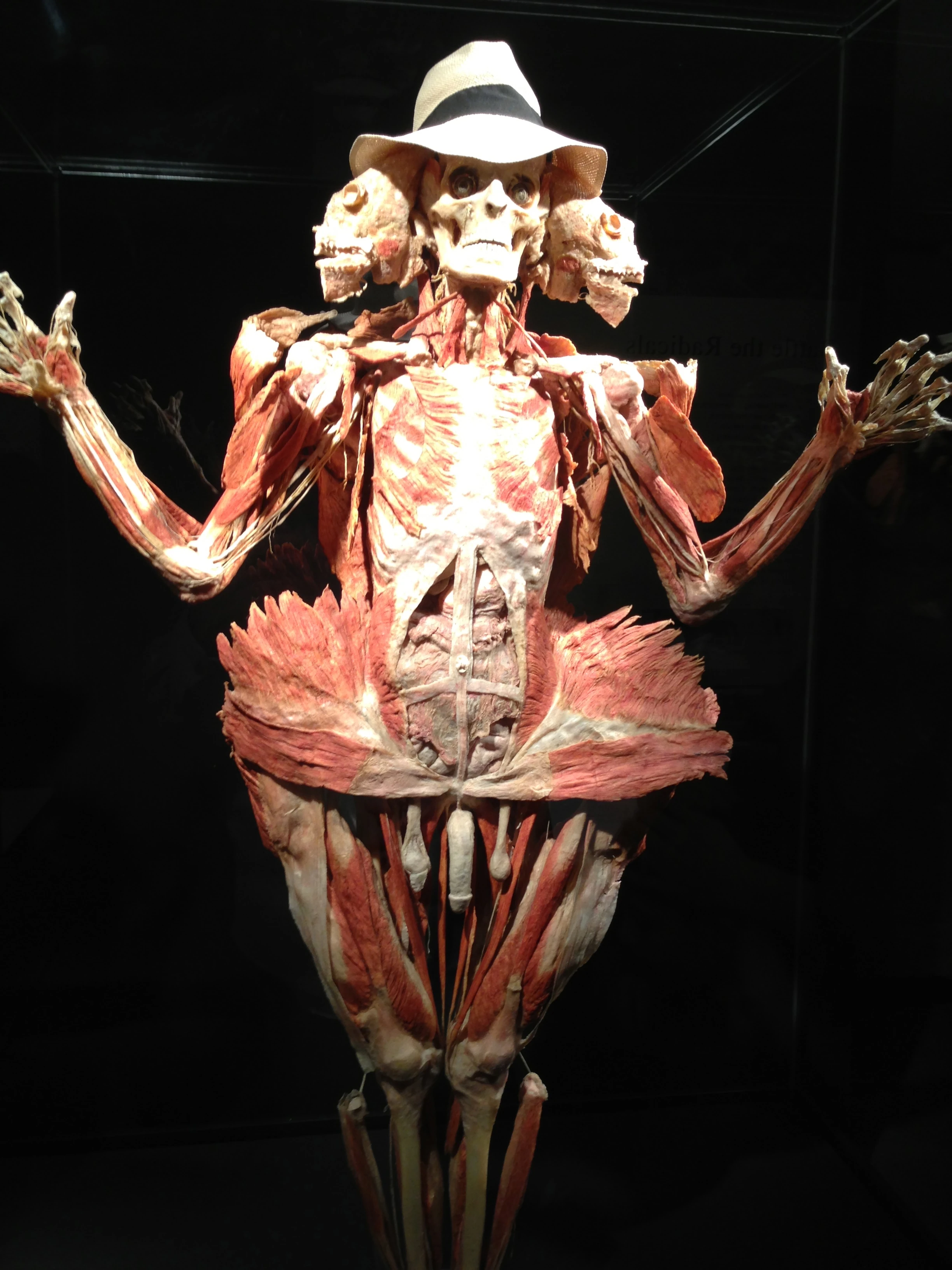 This is an example of the Body World show. It wasn&rsquo;t nearly as gruesome as you might imagine.