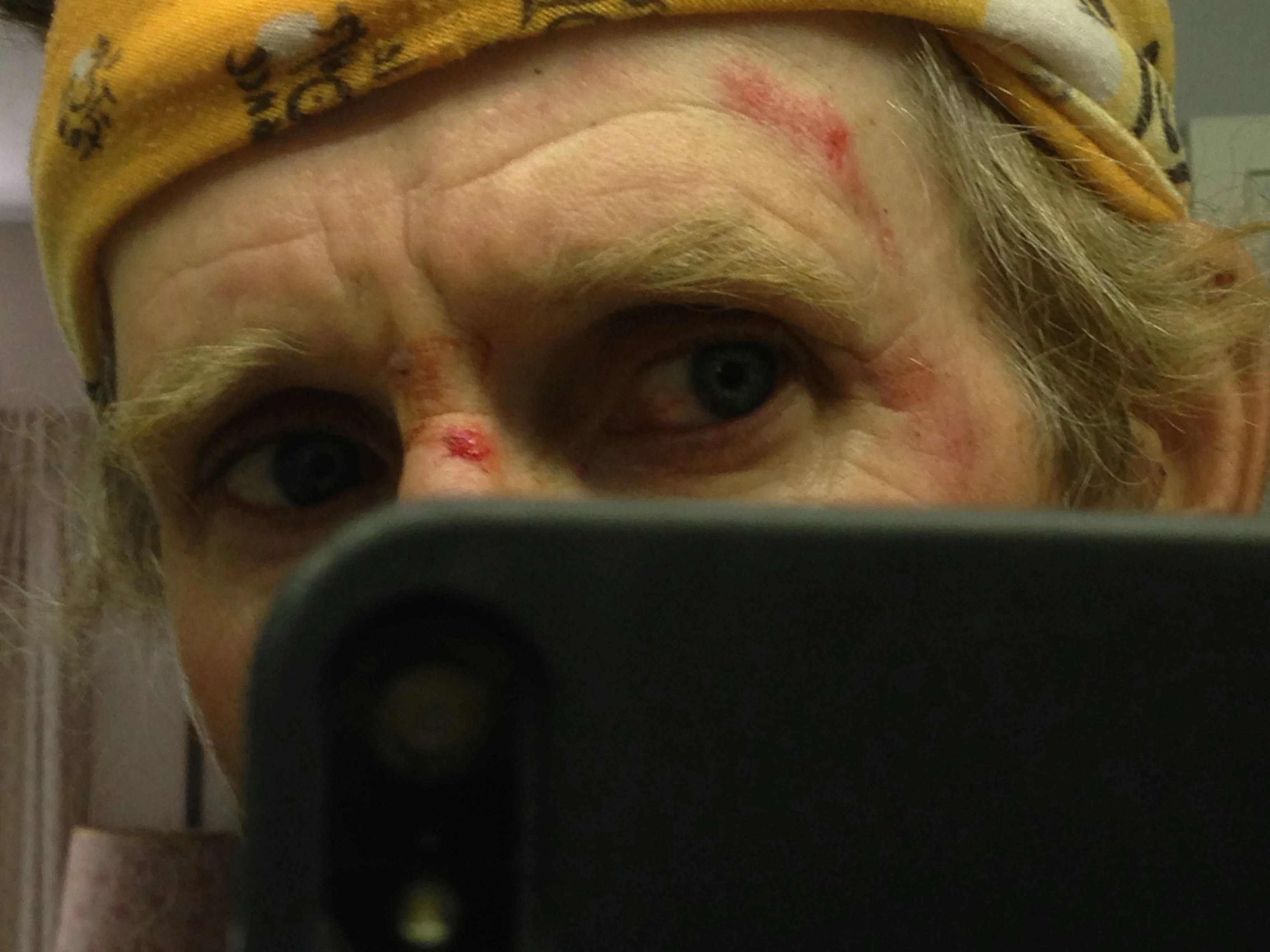 Face photo when I got home.