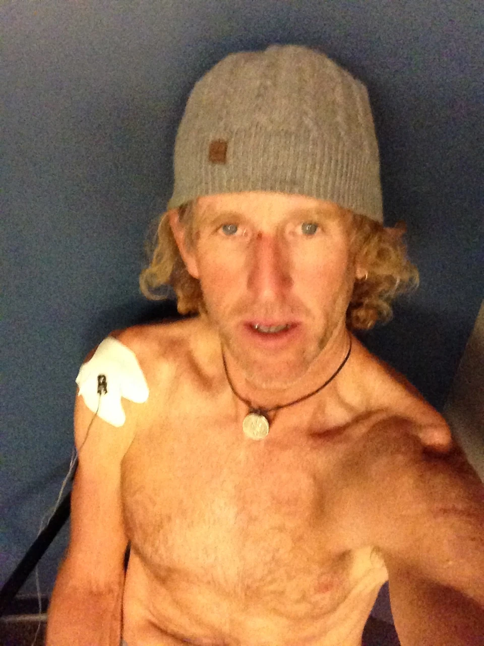 I spent most of the morning over at physical therapy messin&rsquo; with my shoulder. I had to sit in a corner in my shorts while I was getting some medicine electrically driven into my shoulder muscle. I took this picture because I wanted to know if I looked as bad as I felt. I did.