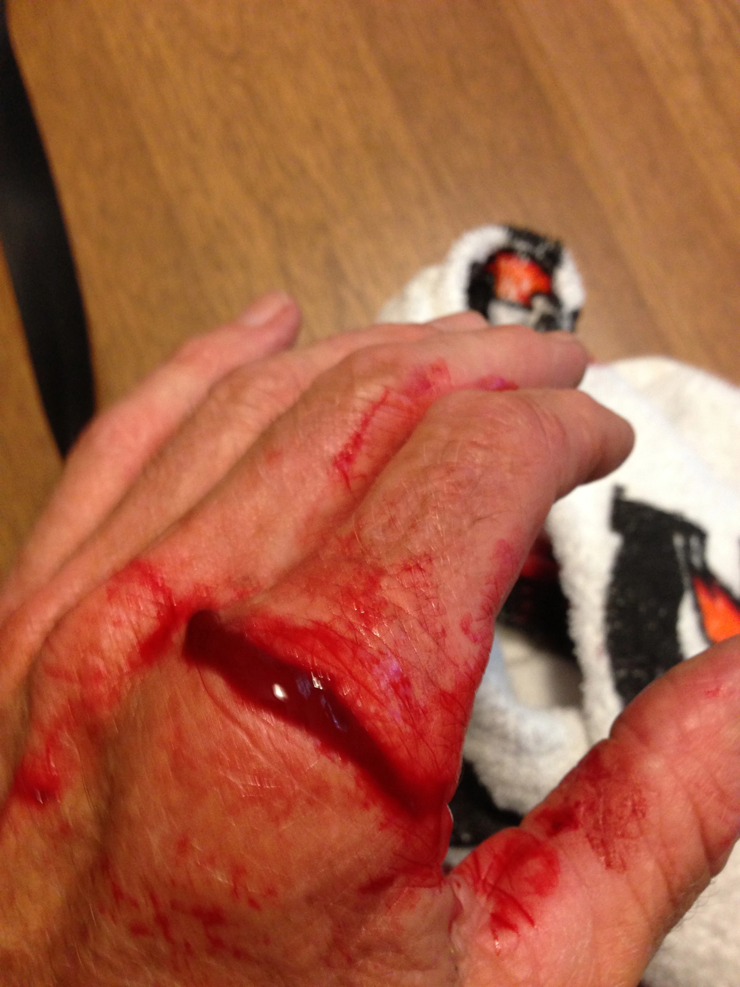 Trying to get a good look at the wound was an issue with all the blood.