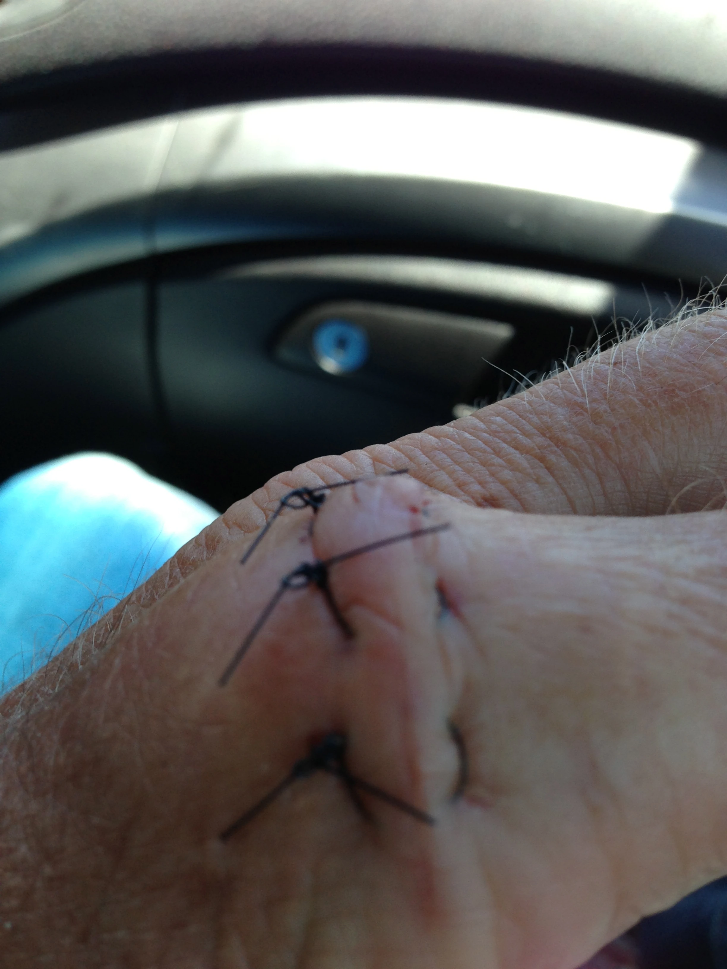 My hand is healing up pretty quickly. I&rsquo;m supposed to leave the sutures in for two more weeks. That seems like a long time. It is over a joint though.