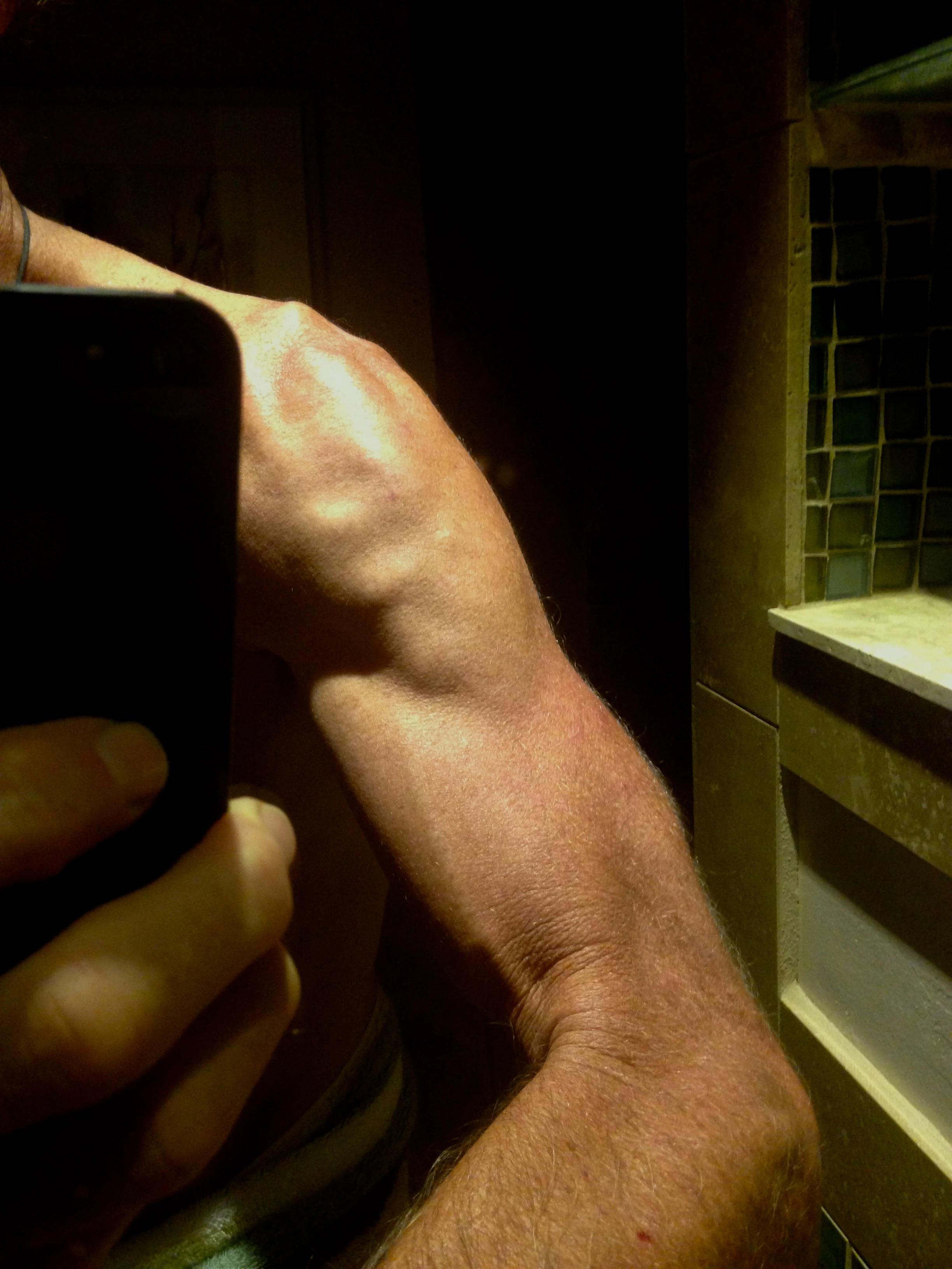 My arm was sort of sore when I got home and I noticed this weird muscle thing going on when I got out of the shower. I emailed the photo to my friend Stacy and she said that it was maybe a Deltoid muscle spasm. It feels solid, just like muscle. Kind of creepy.