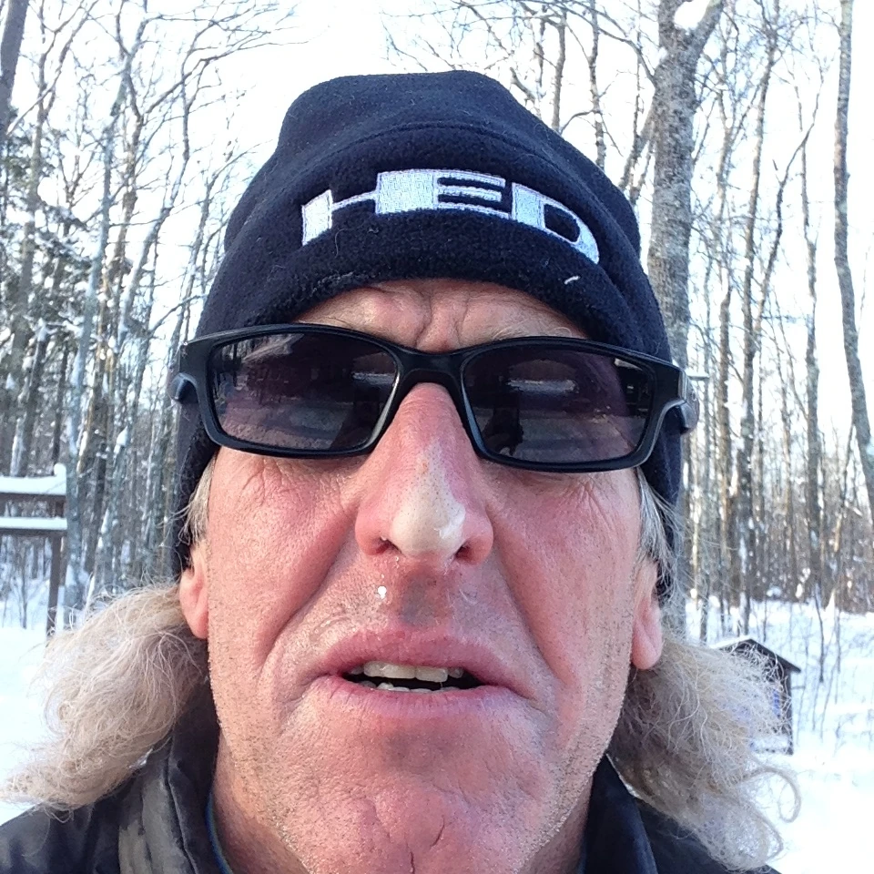 A selfie of the frostbite on my nose.