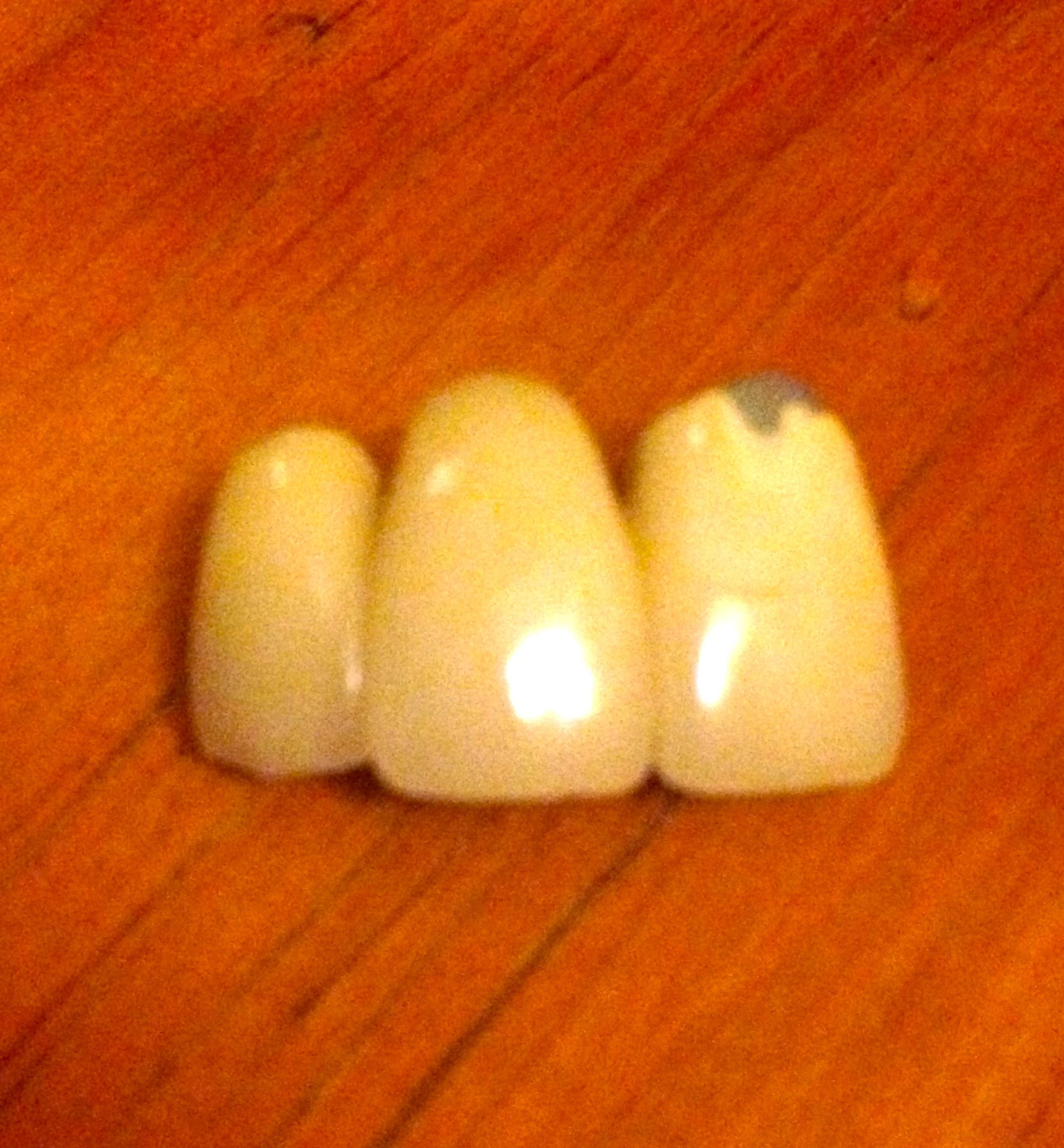 Teeth. They are creepy, sort of . I could never be a dentist.