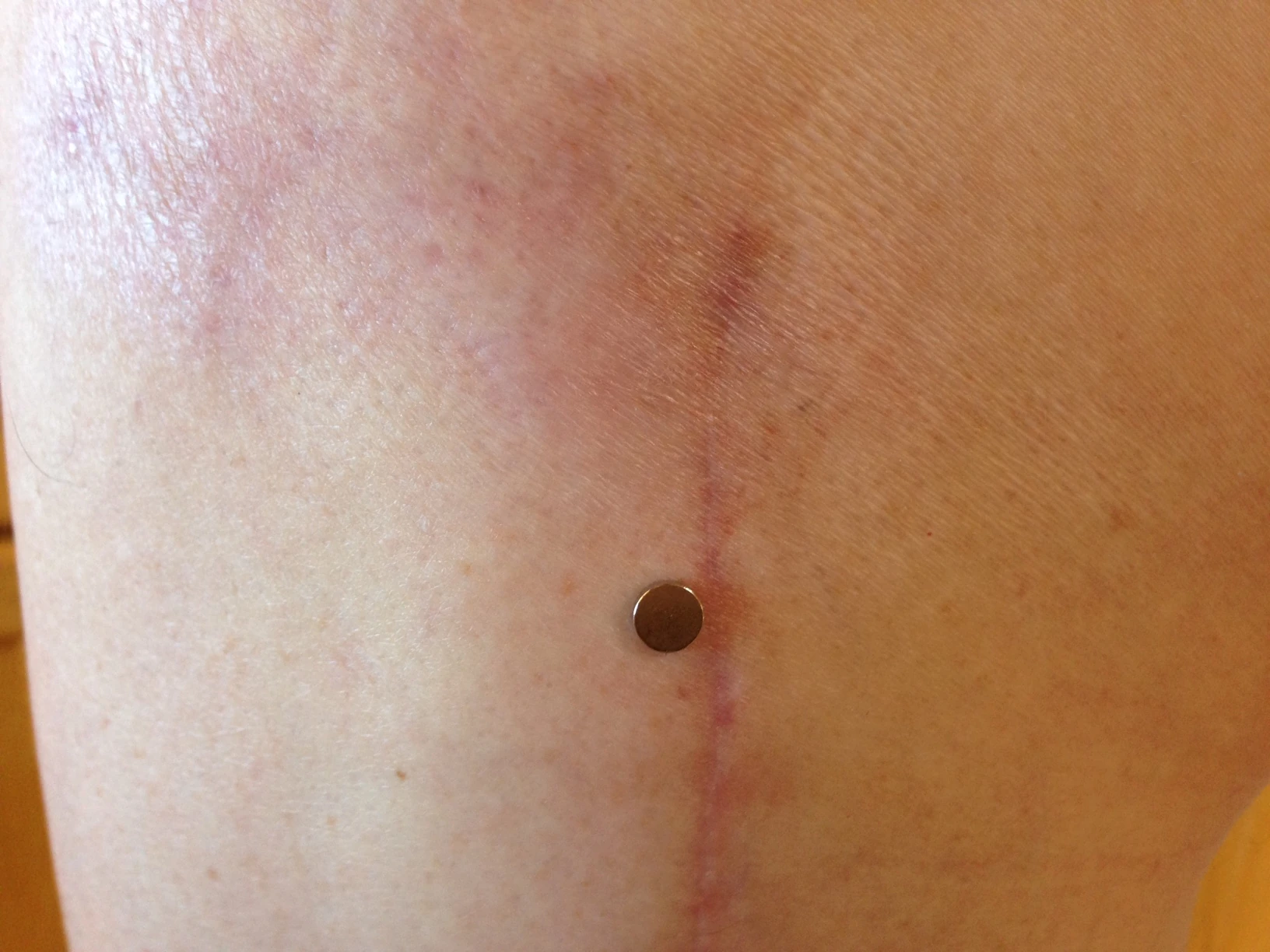 It is kind of creepy that a magnet sticks to my leg now.