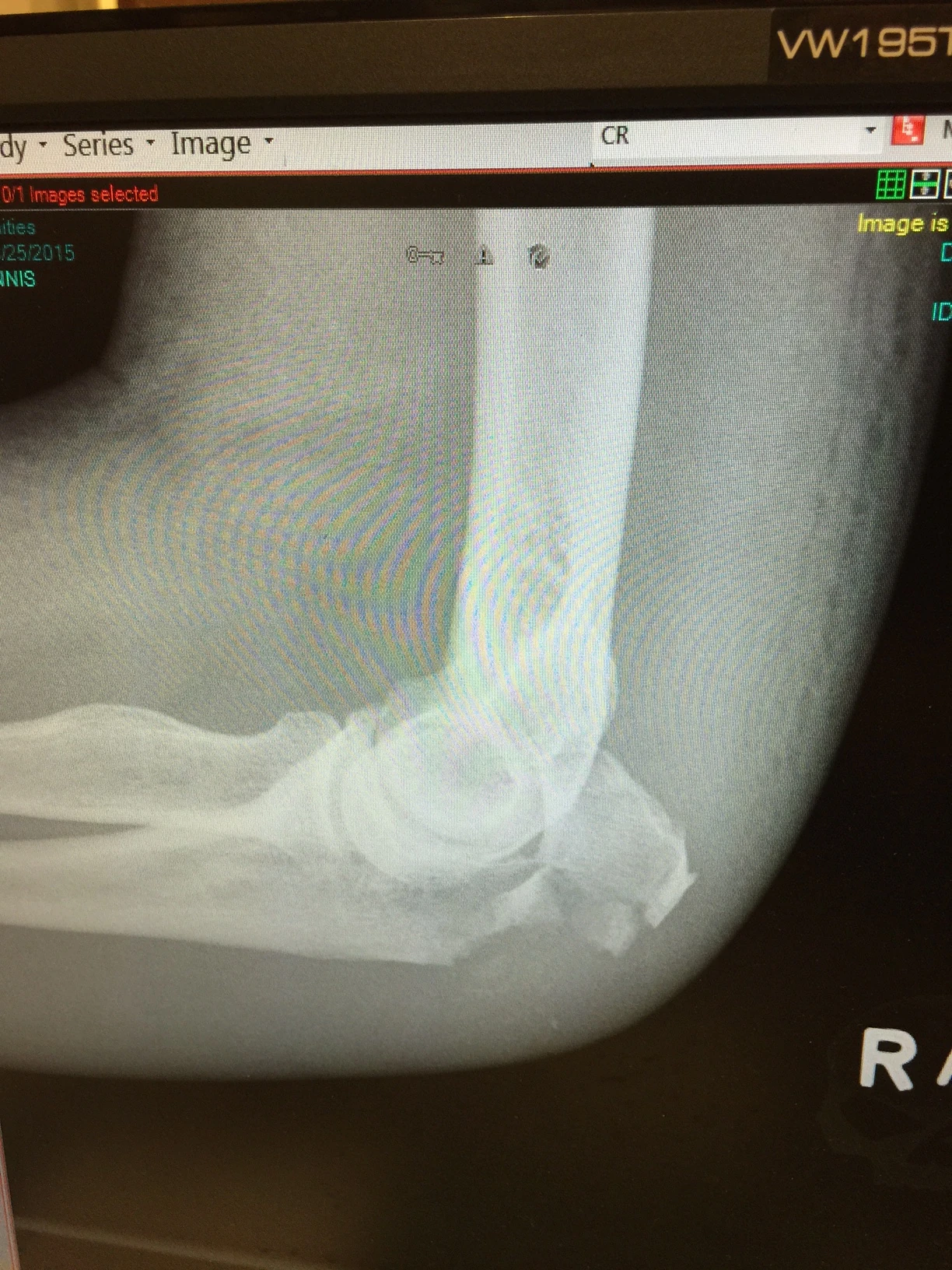 Pretty broken. I can&rsquo;t fix this.