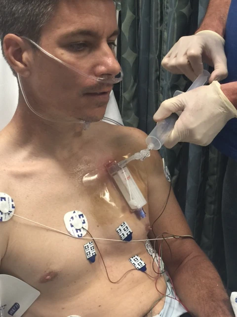 Sucking the air out from behind his lung.