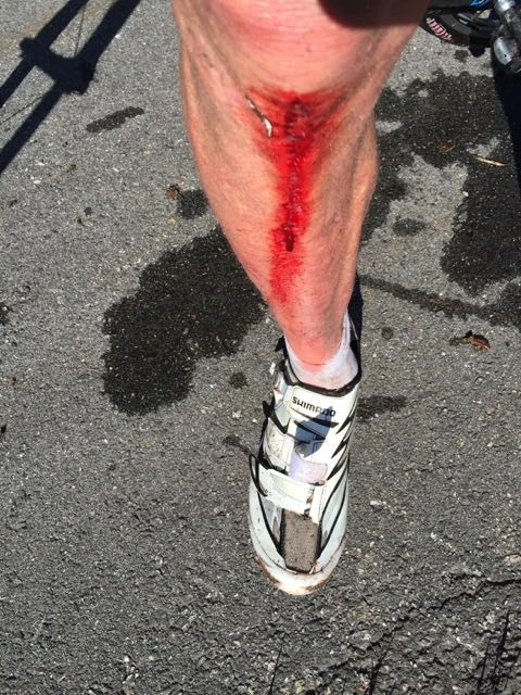 Both my legs were scrapped pretty good.