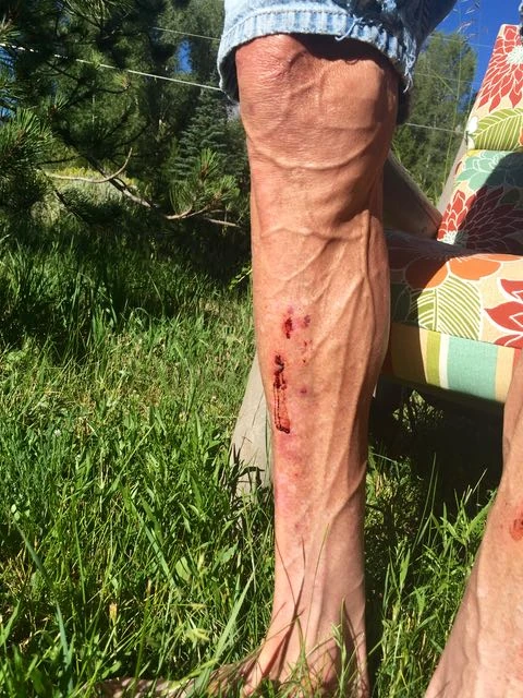 My legs are starting to look a little creepy. I have always had an issue with scrapping up my shins on my pedals mountain biking, so this is nothing new. 