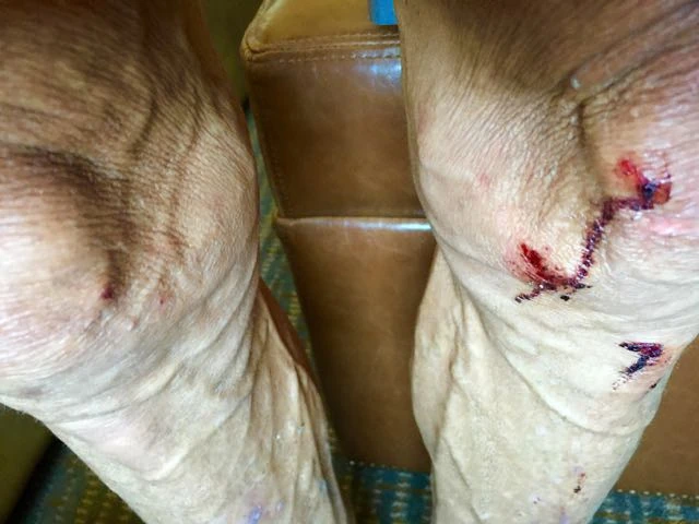 Both my knees were hating me.