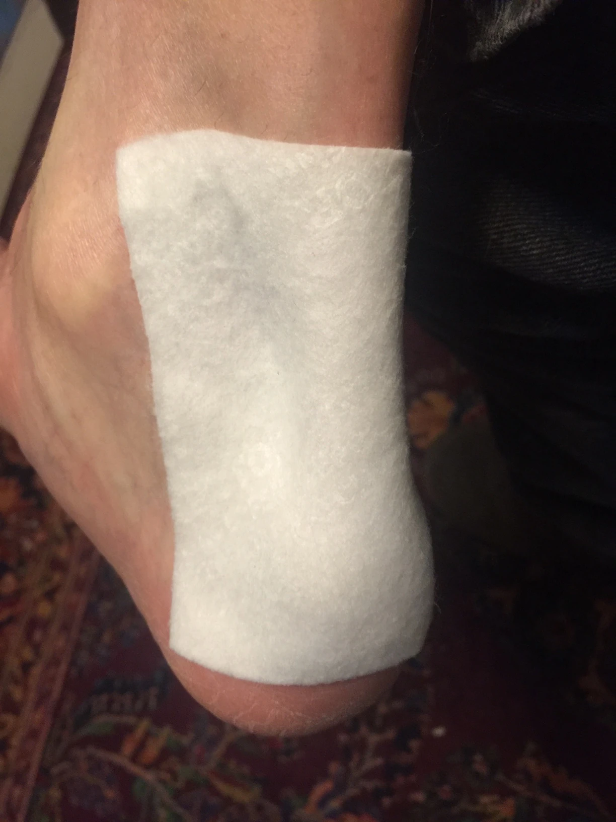 Flexor patch on my tendon.