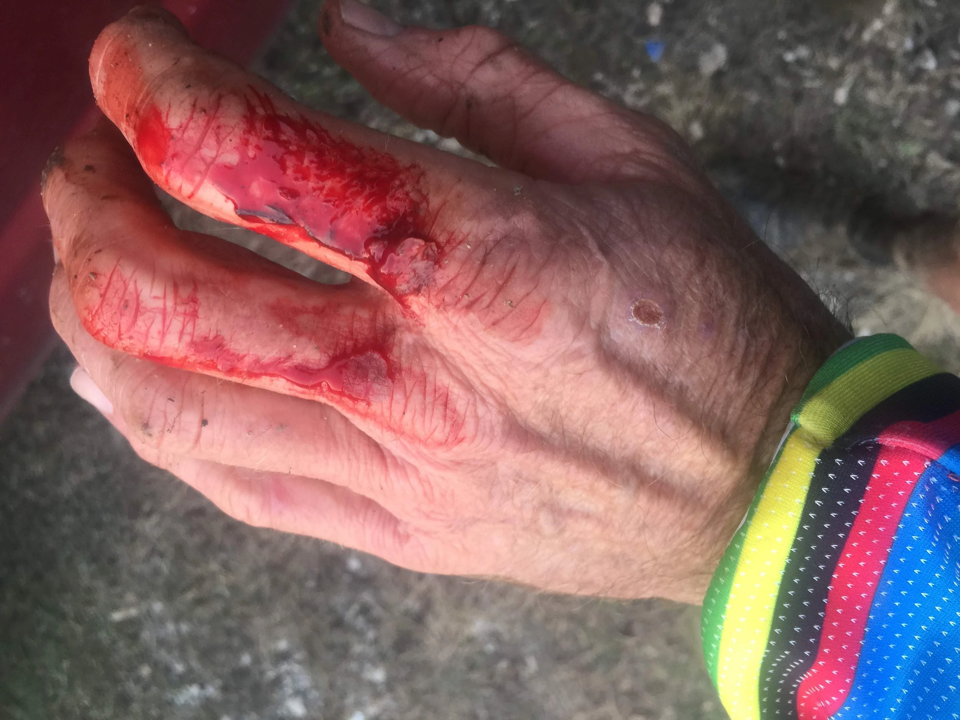 My hand when I took my glove off. It went nearly down to the bone on my index finger. Ouch.