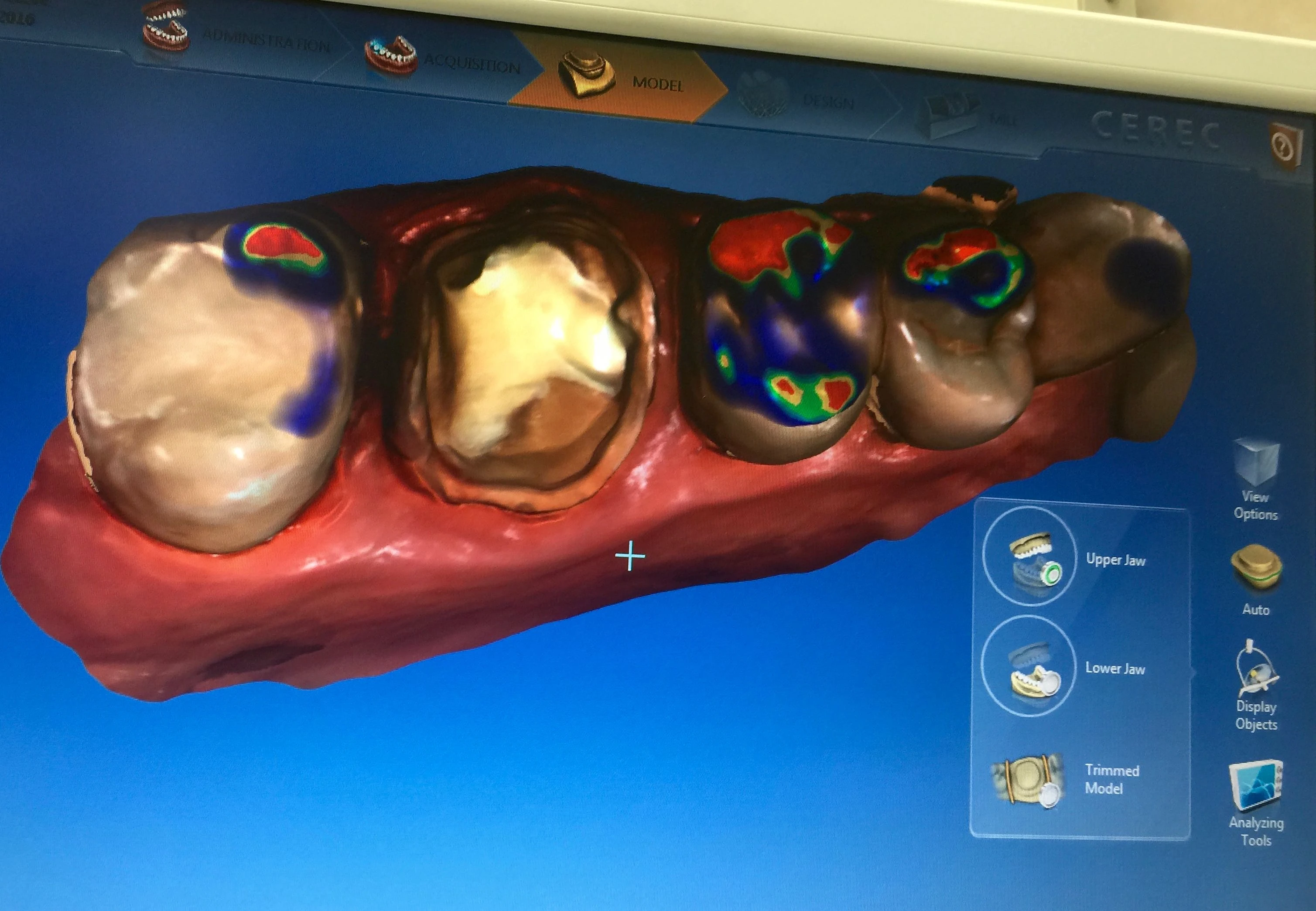 It looks kind of creepy, but it really does show a ton of information.