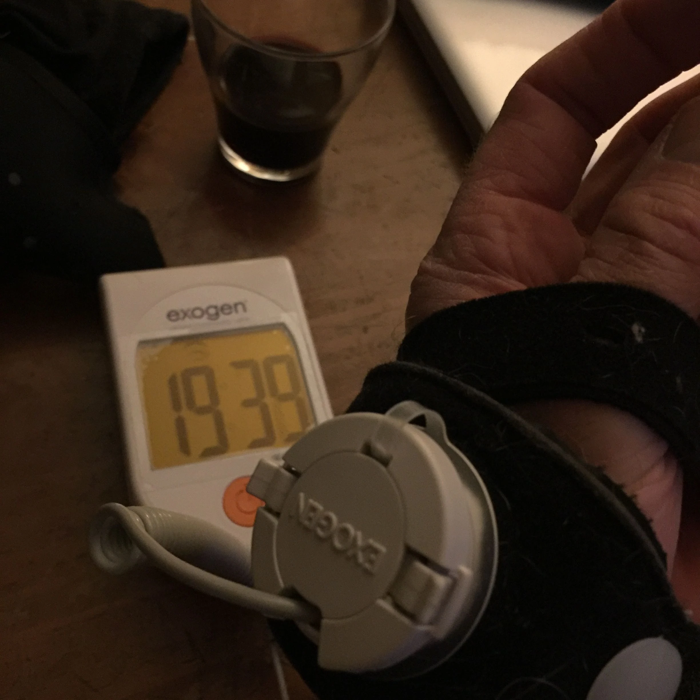 been using this ultrasound bone healing system to help my thumb get better faster. It is hard to tell, but I guess it works.