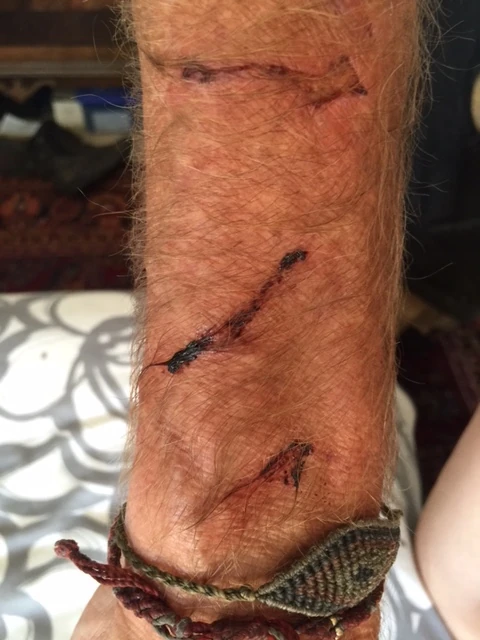 My arms are a mess from playing with Tucker. Sharp teeth and claws.