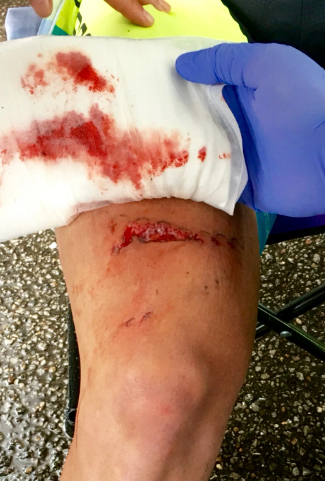 Pretty bad chainring cut.