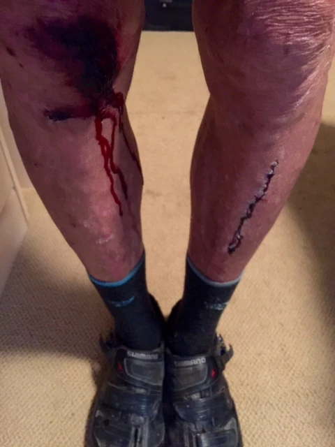 Still dirty, messy legs.