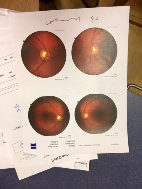 Guess this is a photo of the inside of my eyes. Seem sort of veiny. 