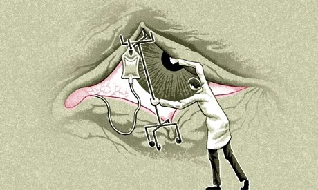 Matt Kenyon right to die