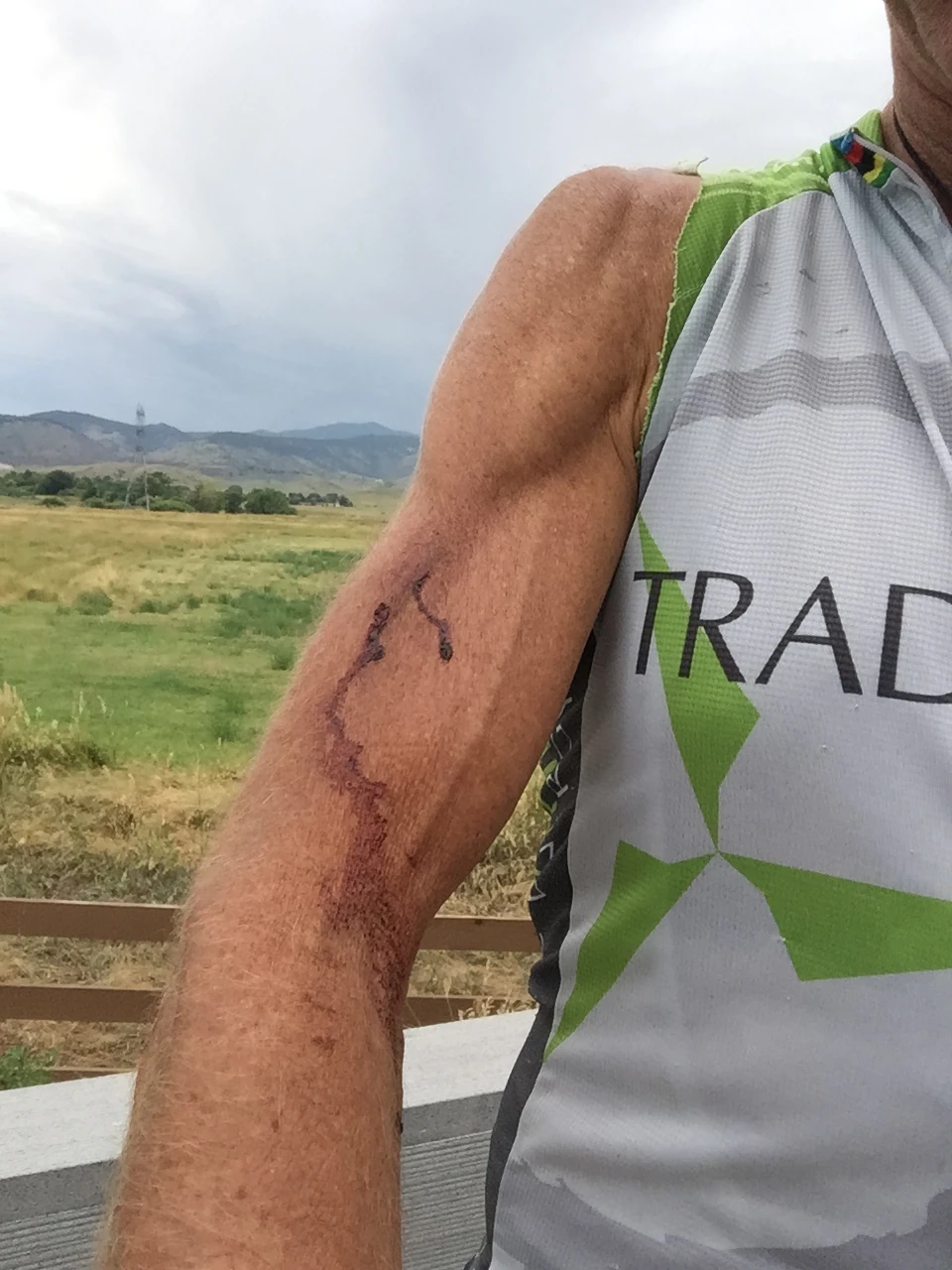 I think you&rsquo;re always bleeding just a little when training and racing MTB.