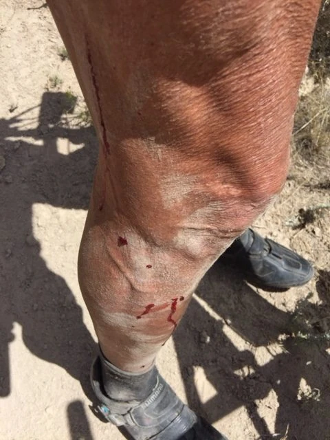 I seem to always draw some blood.