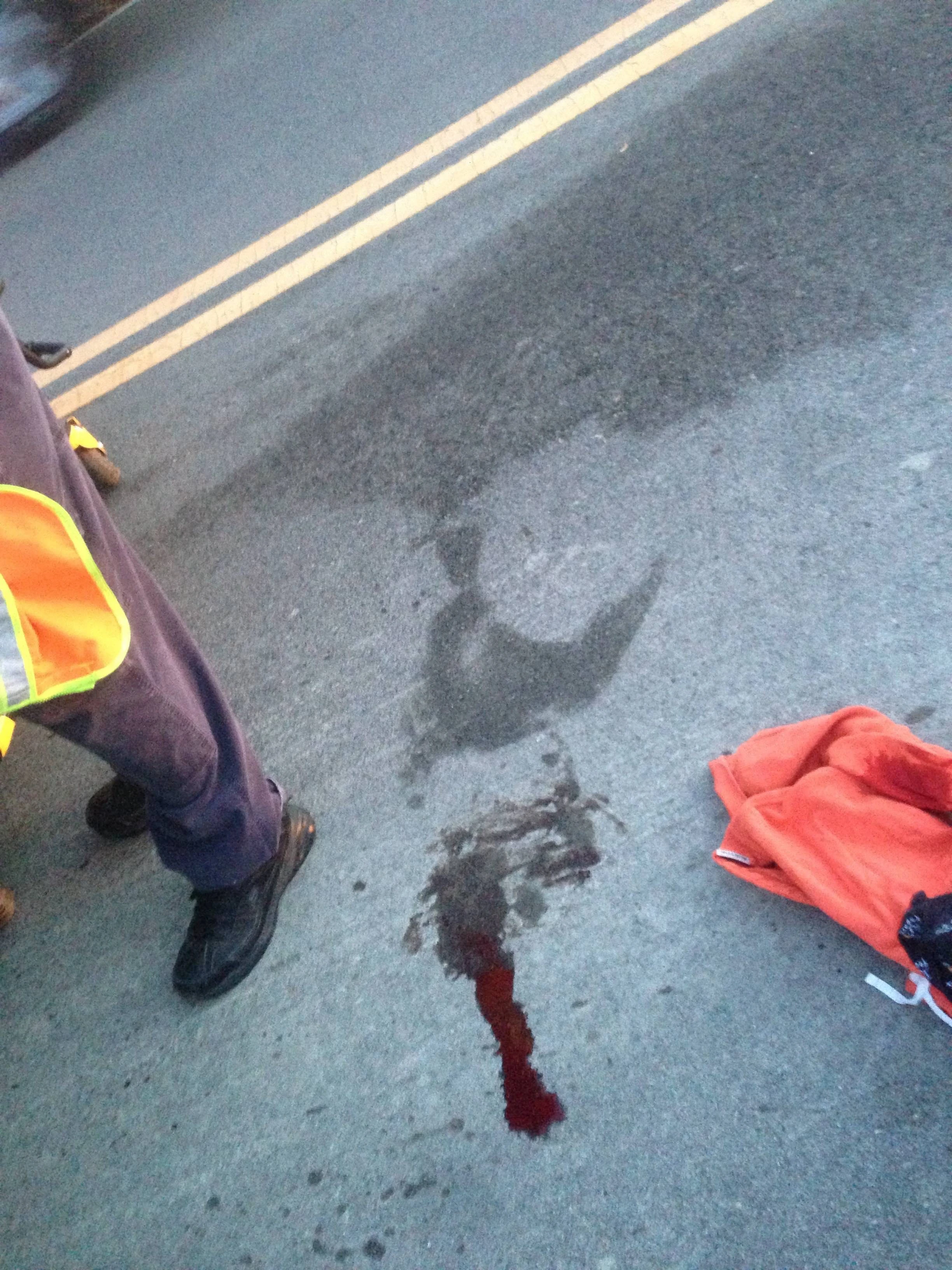 I guess I left a puddle of blood on the ground after I left.